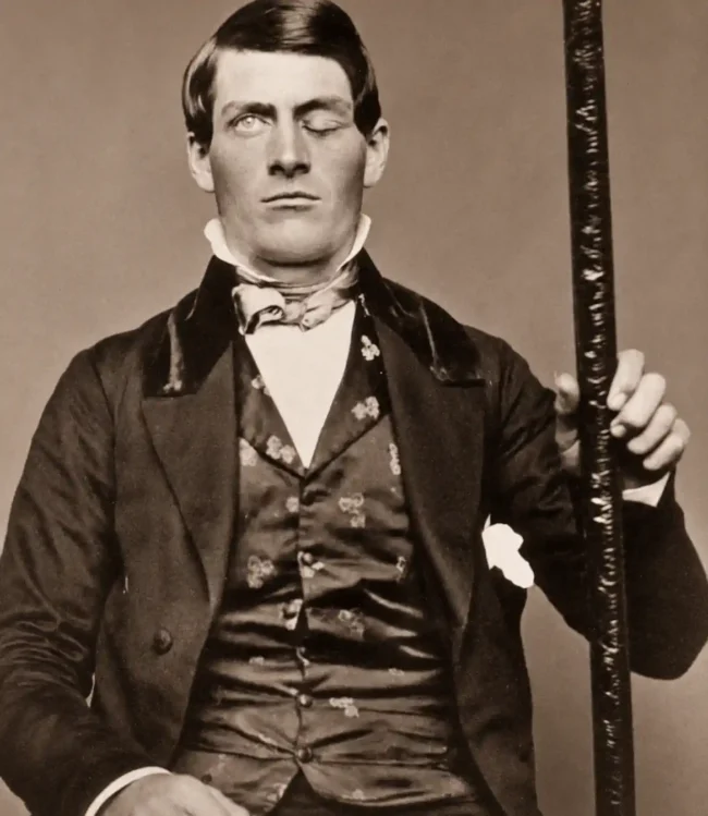 Retrato histórico usado para ilustrar o caso de Phineas Gage, com a barra de ferro associada à lesão cerebral frontal.