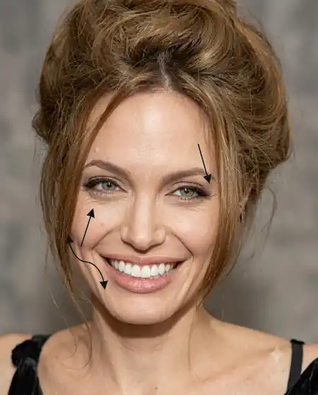 2026-movimentacao-facial-no-sorriso