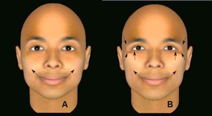 Diferença entre sorriso verdadeiro e falso